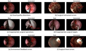 研究显示谷歌AI模型Veo-3可伪造手术视频，缺乏实质性医学理解