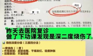 女子上厕所被烫到尖叫弹起！很多人家里都在用……